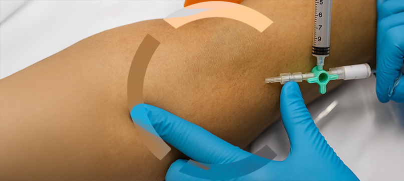 Imagem interna tratamento de vasinhos da face Clariana Casali