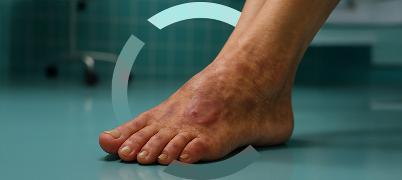 Imagem interna tratamento de vasinhos da face Clariana Casali