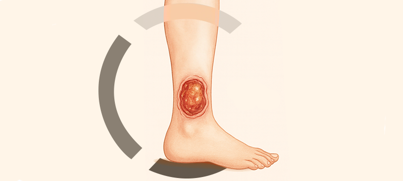 Imagem interna tratamento de vasinhos da face Clariana Casali