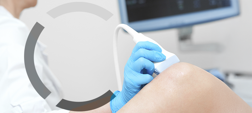 Imagem interna tratamento de vasinhos da face Clariana Casali